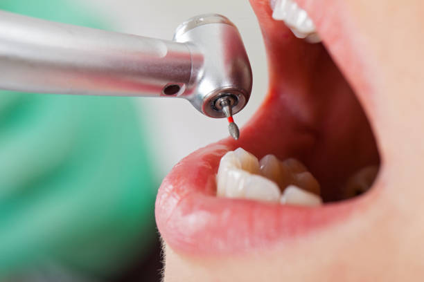 Best Emergency Treatment for Toothache in Swanton, OH